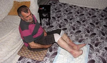 Ayaklarının kesilmesini istemiyor #ankara