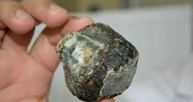 safra kesesi tasi belirtileri nelerdir