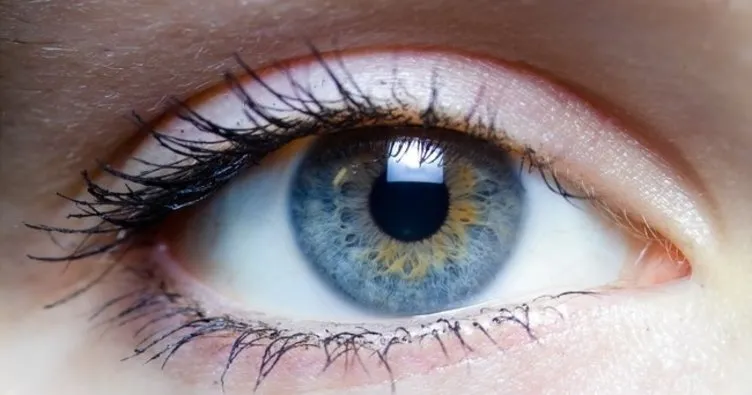 Renk körlüğü kimlerde görülür, belirtileri nelerdir? Tedavisi nasıl yapılır?