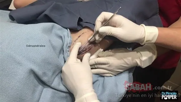 Operasyonla aldırdı gözlerine inanamadı!