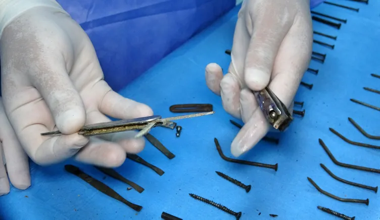 Midesinden 158 parça metal çıktı: Çakı bıçak cımbız ne ararsan var!