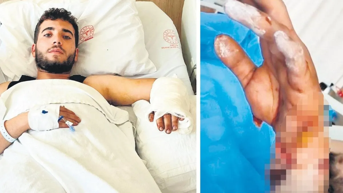 Ankara’da köpek dehşeti! MS hastası genç ağır yaralandı! “Kolundaki dokular ölmeye başlamış” Ankara’da köpek dehşeti! MS hastası genç ağır yaralandı! “Kolundaki dokular ölmeye başlamış”