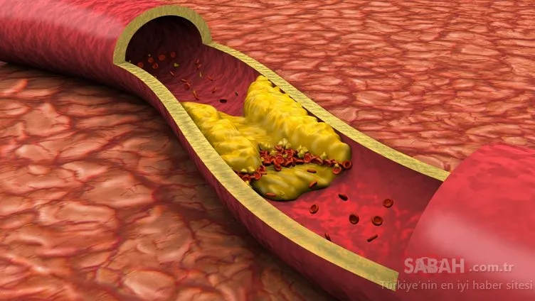 Birçok kişinin ortak sorunu olan kolesterolü düşürücü 13 besin!