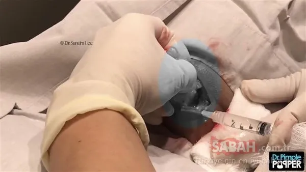 Doktora bu halde geldi! Sonrasındaysa...