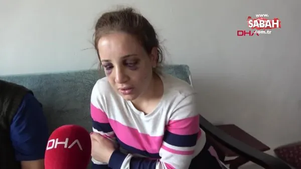 Aydın'da boşanma aşamasındaki eşini darbeden kişiye elektronik kelepçe takıldı | Video