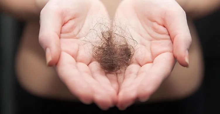 Saç dökülmelerine kökten çözüm