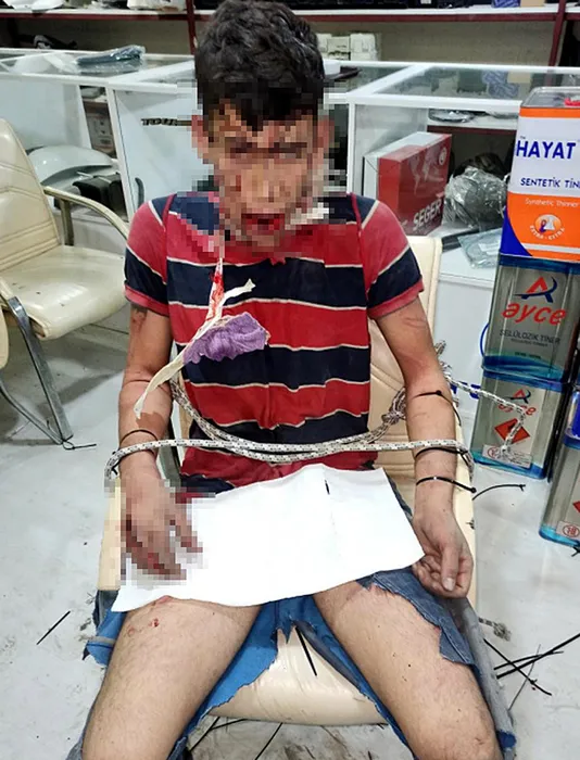 Antalya’da işçiye korkunç işkence: Üç gün dövdüler, dişlerini kırıp, böcek yedirdiler