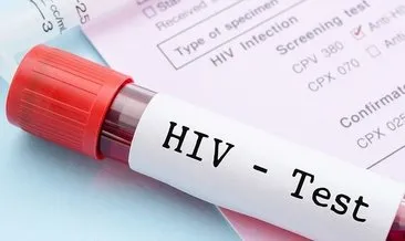 1 Aralık Dünya AIDS Günü bugün! AIDS Günü nedir, AIDS nasıl bulaşır ve belirtileri nelerdir?