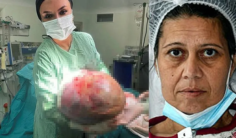 Kadın hastanın karnından çıktı: Doktorlar bile gözlerine inanamadı!