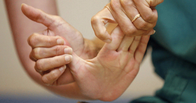 Akut Eklem Romatizmasi Aer Nedenleri Belirtileri Ve Tedavi Yontemleri Nelerdir Saglik Haberleri