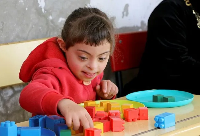 Down Sendromu Nedir Down Sendromu Belirtileri Nelerdir Sayfa 2 Son Dakika Haberler