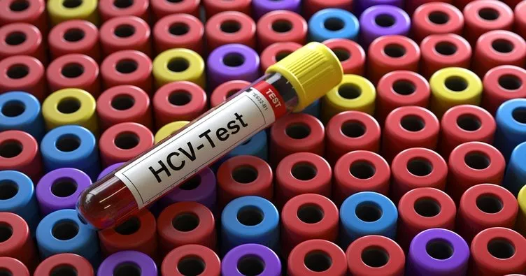 Anti HCV nedir? Anti HCV negatif ne demek? Normal değerler kaç olmalı?