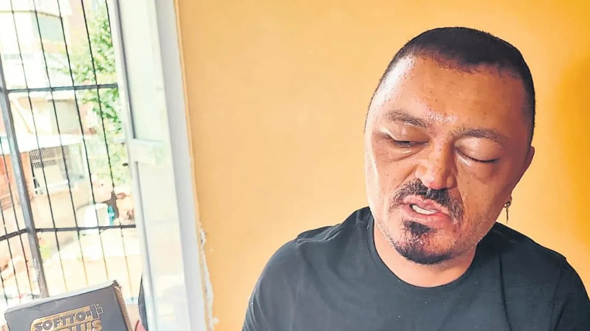 Aldığı şampuan kabusu oldu