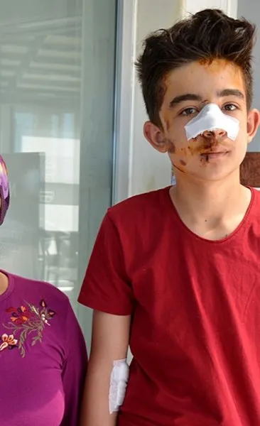 Antalya’da başıboş köpek dehşeti! 15 yaşındaki Hamitcan: Bayılmışım, ambulans geldiğinde uyandım