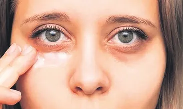 Göz çevresindeki koyu halkalara dikkat