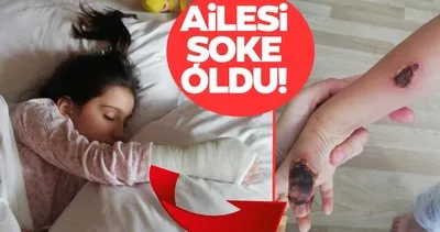 Son dakika | İstanbul’daki özel hastanede skandal! MR odasında küçük Elif’i yaktılar!
