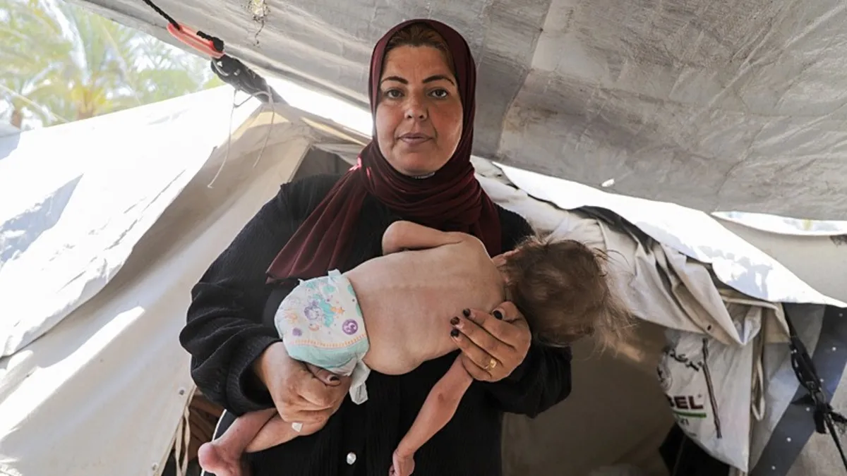 Gazze’de bebeklerin katli sürüyor – Son Dakika Haberler