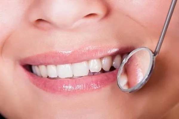 Diş eti büyümelerinde ilk adım ağız temizliği ve bakımı