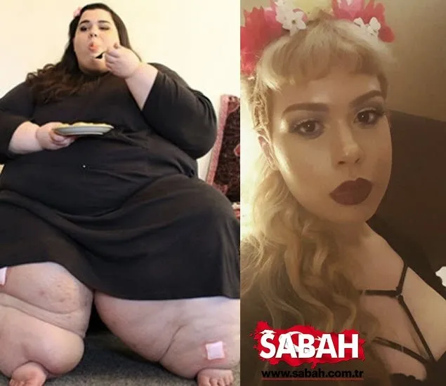 Ölümden döndü 223 kilo verdi! Azmin zaferi… Sayfa 3 Son Dakika