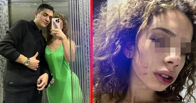 Konya’da dehşet! Sevgilisini önce arabada sonra evde darbetti! Sana bir sürprizim var...