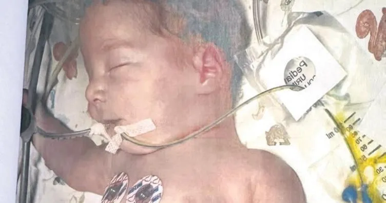 2 aylık bebeğin ölümünde anne-baba şüphesi