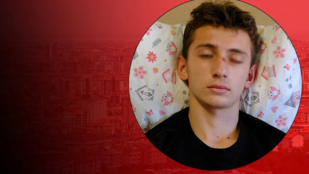 Konya'da 16 yaşındaki çocuğu gözünden etti: Bu tehlikenin adı 'eğlence'! Ulaşması çok kolay… Konya'da 16 yaşındaki çocuğu gözünden etti: Bu tehlikenin adı 'eğlence'! Ulaşması çok kolay…