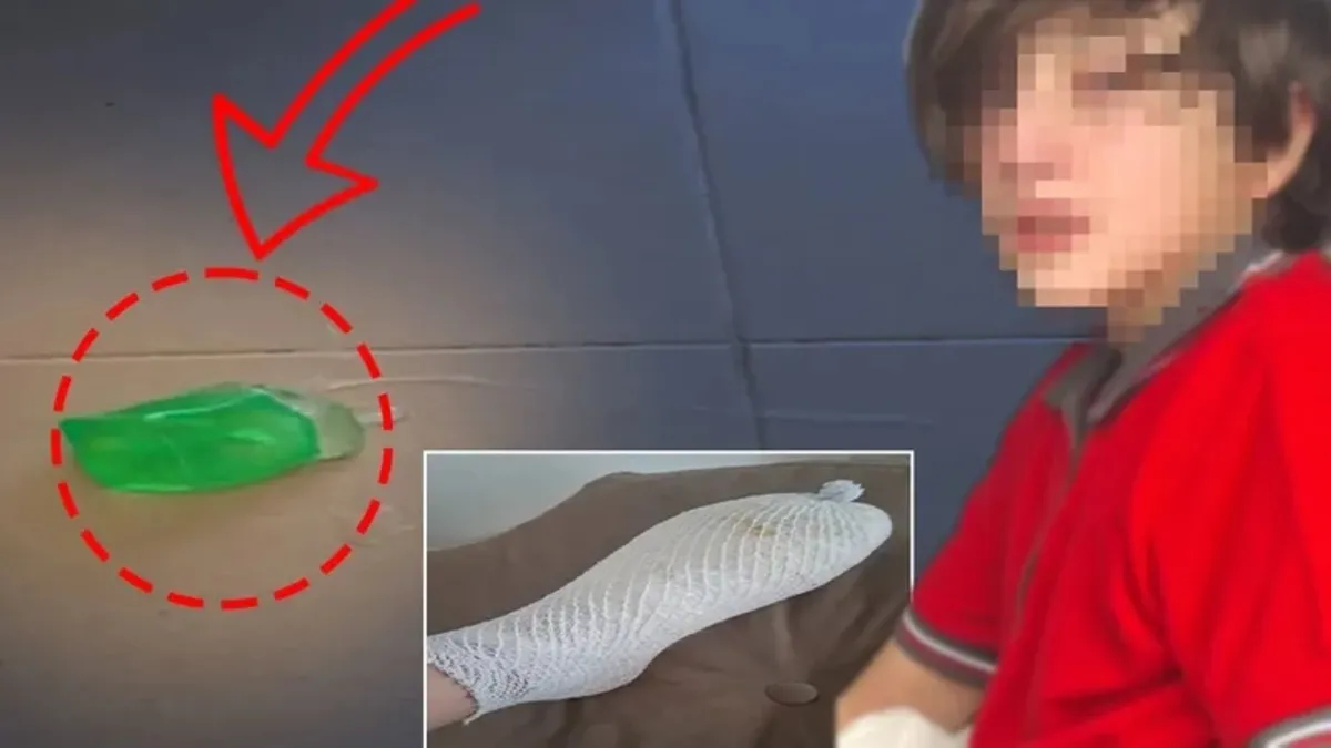 Oyuncak 11 yaşındaki Furkan'ın elinde patladı: Ailesi suç duyurusunda bulundu! | Video