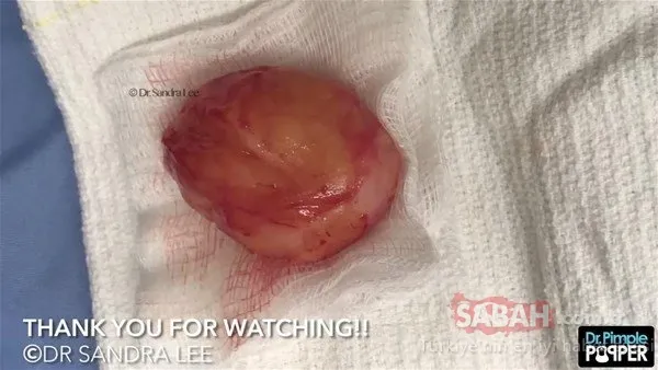 Doktora bu halde geldi! Sonrasındaysa...