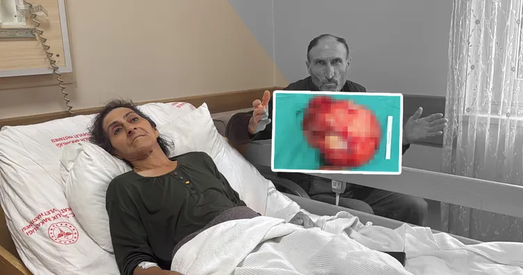 Karın ağrısı şikayetiyle hastaneye gitti! Karnından öyle bir şey çıktı ki! Tam 6 kilo!