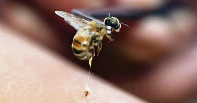 Arı sokmasına ne iyi gelir, ne yapılır? Arı sokması şişliği ne kadar zamanda iner, şişlik ve kaşıntı nasıl geçer?