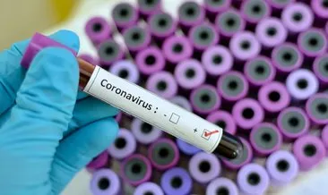 Corona virüsü aşısı bulundu mu, tedavisi var mı? COVİD 19 Koronavirüsü aşı ve tedavi çalışmalarında son durum nedir?