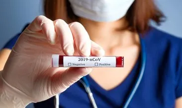 Son dakika haberler: Koronavirüs ile kan grupları arasında bir bağlantı var mı? Bilim Kurulu Üyesi yanıtladı!