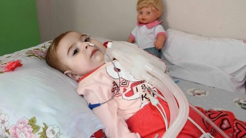 sma hastaligi nedir sma belirtileri