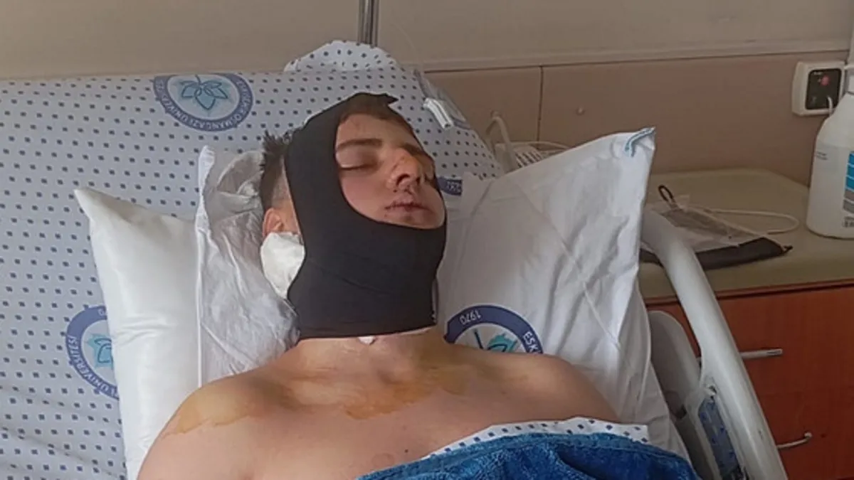 Kavga ettikleri öğrencinin omuriliğini ve çenesini kırmışlardı! Akran zorbalığına tutuklama kararı Kavga ettikleri öğrencinin omuriliğini ve çenesini kırmışlardı! Akran zorbalığına tutuklama kararı