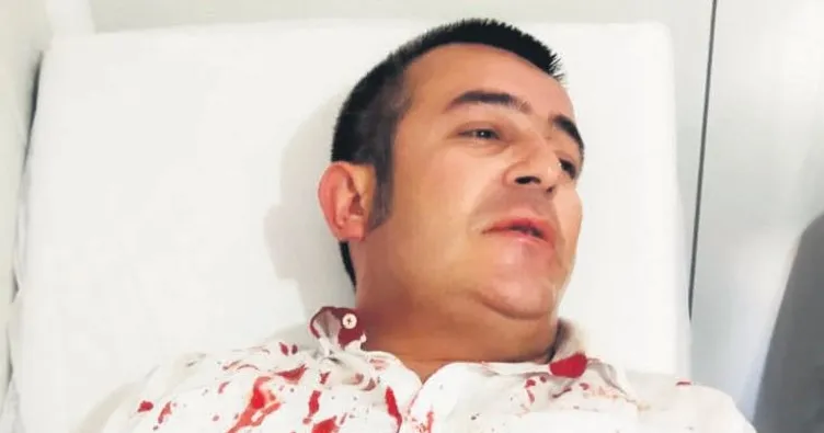 Kravatımla beni boğmaya çalıştılar