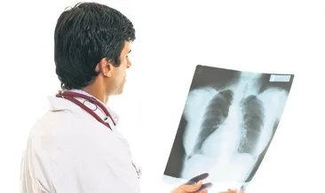 Öksürürken kaburgalarınız kırılabilir!