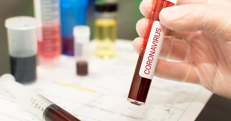 Koronavirüsten korunmanın yolları neler?