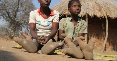 Dehşete düşüren devekuşu halkı! Sadece 2 ayak parmakları var ve koşamıyorlar