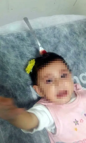 İzmir’de 9 aylık bebeğin başına, ablasının fırlattığı çatal saplandı