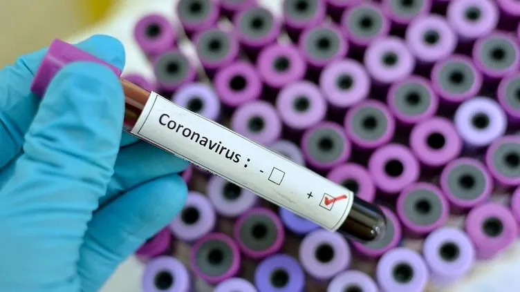 Son dakika: Koronavirüs Bilim Kurulu Üyesi Prof. Dr. Okyay vaka sayılarını değerlendirdi