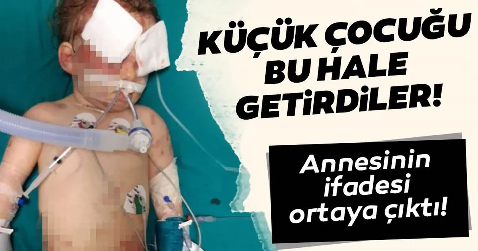 Son dakika Antalya�da köpek vahşeti! Acılı anne yaşadığı kabusu