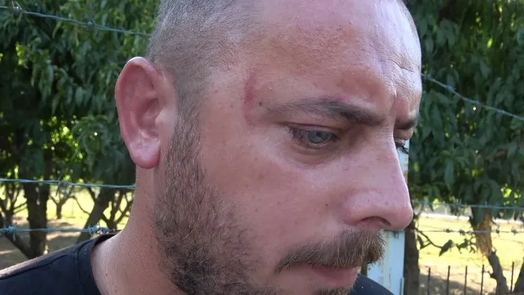 İstanbul’daki kafede enginar dayağı: Olayın sıcaklığıyla hissetmedim! Sebebi...