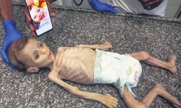 7 aylık bebeği açlıkla: Katlettiler