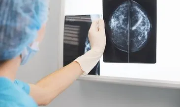 Mamografi Nasıl Çekilir? Mamografi Çekimi Ne Kadar ve Kaç Dakika Sürer, Hangi Pozisyonda Çekilir?