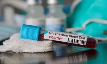 E-Nabız girişi, covid test sonucu sorgulama işlemi: E-devlet şifresi ile koronavirüs test sonucu e-nabızla nasıl öğrenilir?