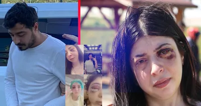 Samsun’da sokak ortasında darp skandalı! Yüzümde bir demirle yaşamak zorundayım...