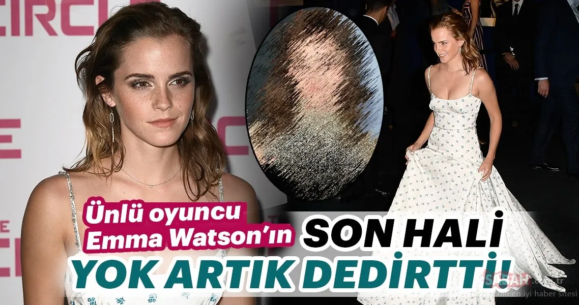 Ünlü oyuncu Emma Watson’ın son hali yok artık dedirtti! Galeri Kadın