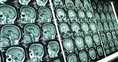 Türkiye’de 3 dakikada bir kişi...