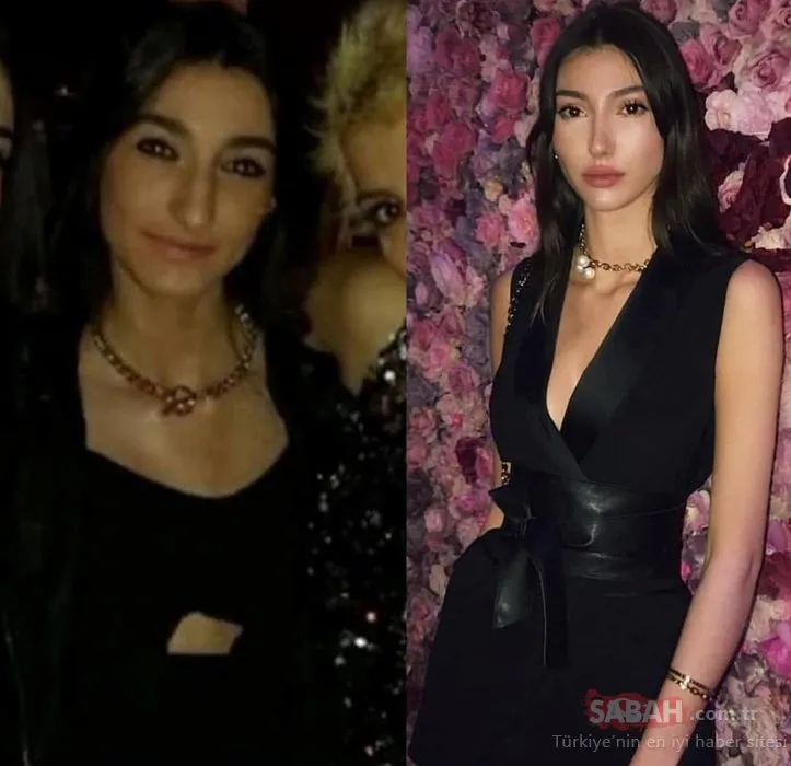 Miss Turkey ödülü doktorun hakkı! Şevval Şahin�in estetiksiz hali olay