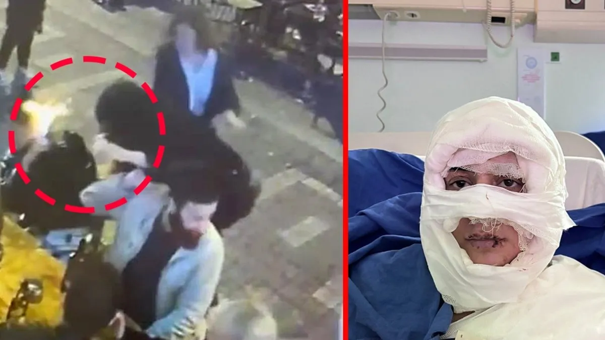 SON DAKİKA: Kadıköy’deki vahşet Türkiye’yi sarstı! Sokak ortasında çakmakla yakılmıştı! “Kız kardeşim sizin yüzünüzden…” SON DAKİKA: Kadıköy’deki vahşet Türkiye’yi sarstı! Sokak ortasında çakmakla yakılmıştı! “Kız kardeşim sizin yüzünüzden…”